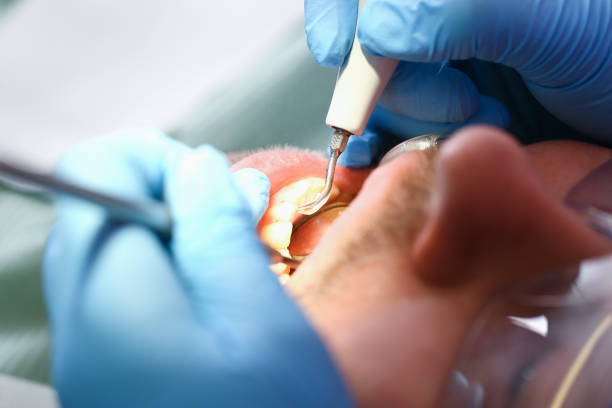 Dentist for Dental Trauma in NM
